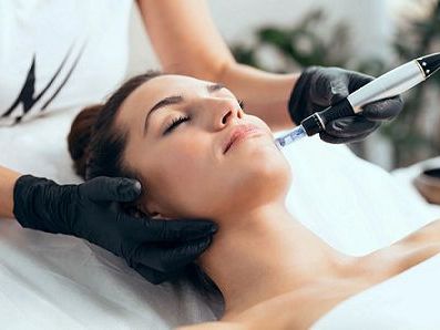 microneedling-tampa-for-smooth-and-radiant-skin