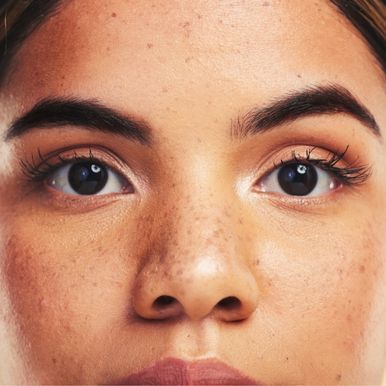 brow-lift-treatment-in-los-angeles-big-1