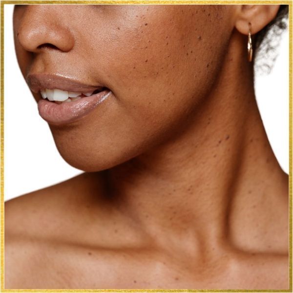 neck-lift-surgery-in-los-angeles-big-3