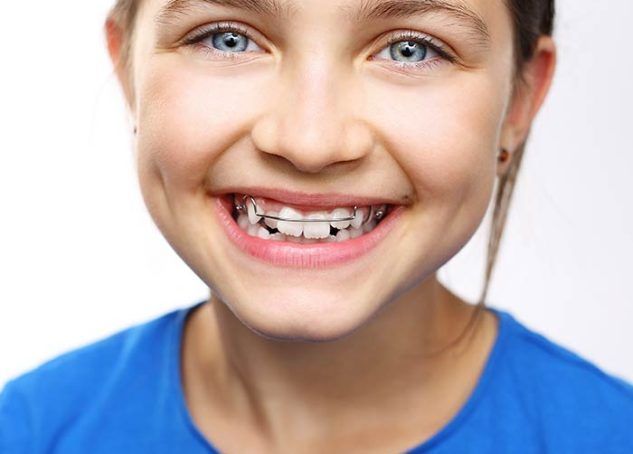 benefits-of-early-phase-1-orthodontics-big-0