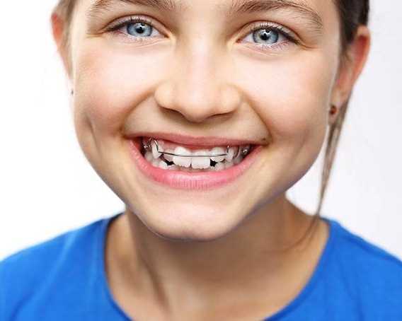 benefits-of-early-phase-1-orthodontics