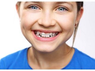 benefits-of-early-phase-1-orthodontics-small-0