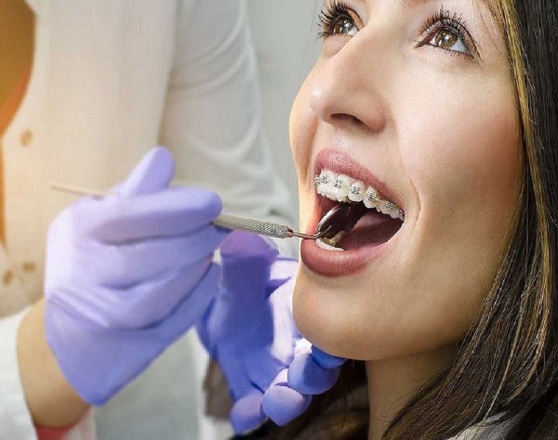 dental-cleaning-fort-worth-professional-teeth-cleaning-big-0