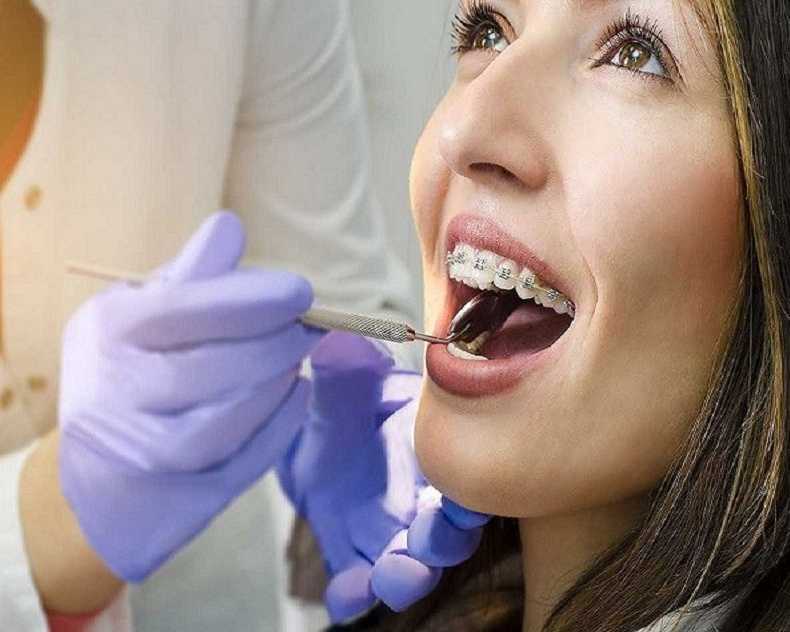 dental-cleaning-fort-worth-professional-teeth-cleaning