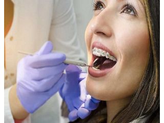 dental-cleaning-fort-worth-professional-teeth-cleaning-small-0