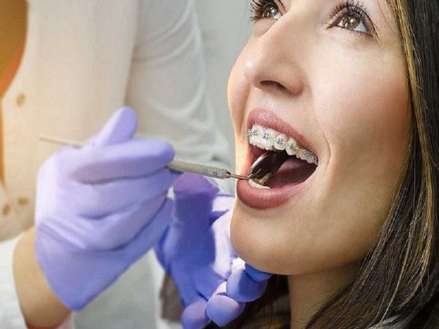 dental-cleaning-fort-worth-professional-teeth-cleaning