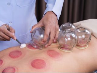 cupping-therapy-greenville-sc-for-natural-relief-wellness-care-small-0