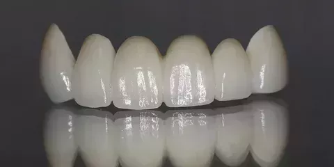 zirconia-dental-implants-metal-free-solution-for-a-natural-smile-big-0