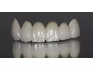 zirconia-dental-implants-metal-free-solution-for-a-natural-smile-small-0