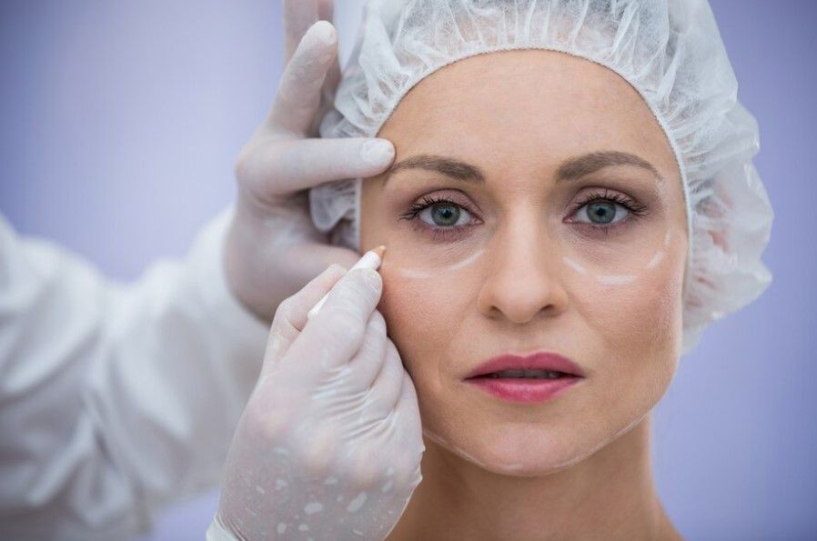 blepharoplasty-surgeons-coral-gables-eyelid-surgery-big-0