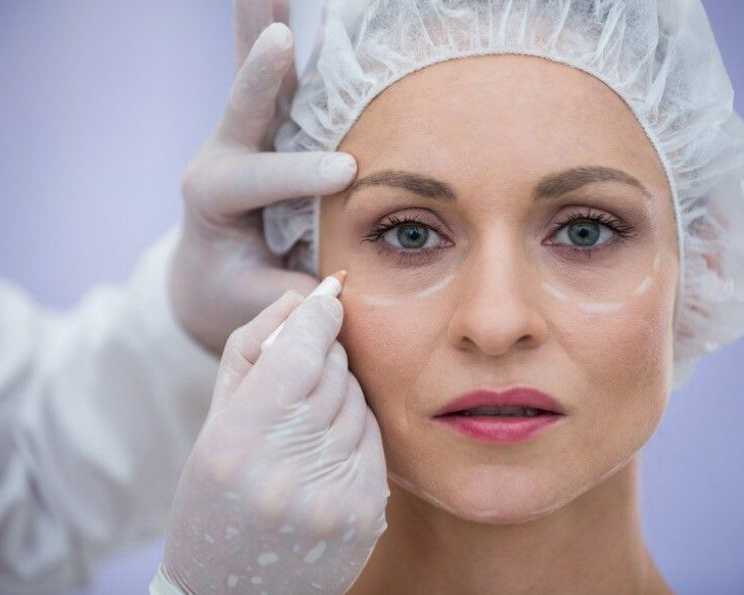 blepharoplasty-surgeons-coral-gables-eyelid-surgery