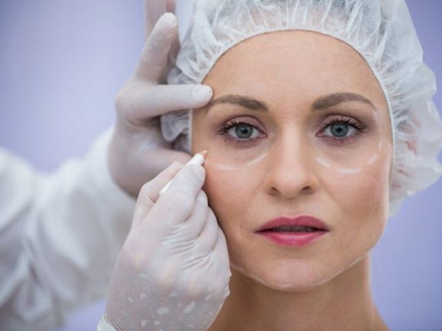 blepharoplasty-surgeons-coral-gables-eyelid-surgery