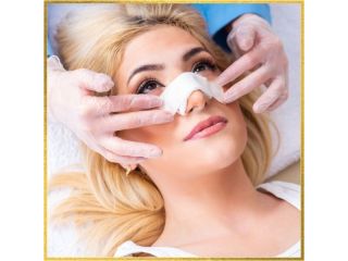rhinoplasty-in-los-angeles-small-3