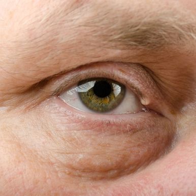 eyelid-surgery-in-los-angeles-big-0