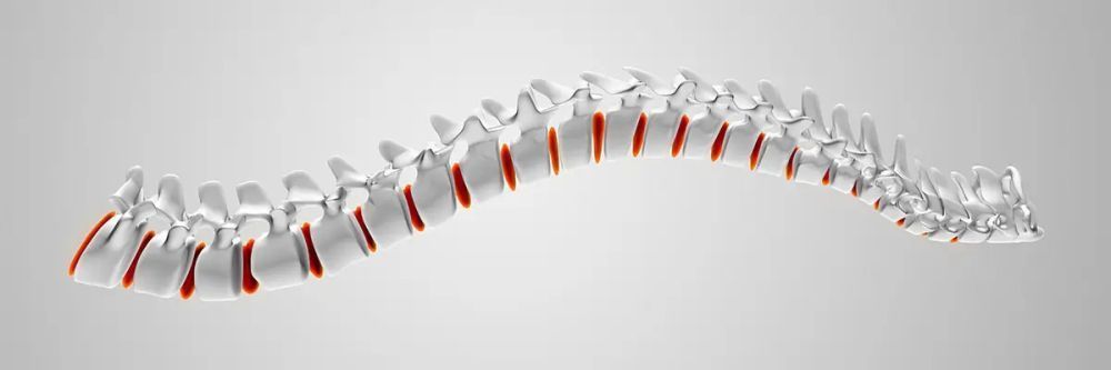 3d-spinal-decompression-therapy-mckinney-kurv-o2-care-big-0