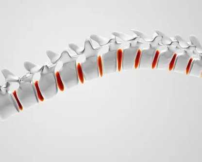 3d-spinal-decompression-therapy-mckinney-kurv-o2-care
