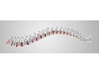 3d-spinal-decompression-therapy-mckinney-kurv-o2-care-small-0