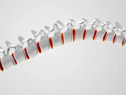 3d-spinal-decompression-therapy-mckinney-kurv-o2-care