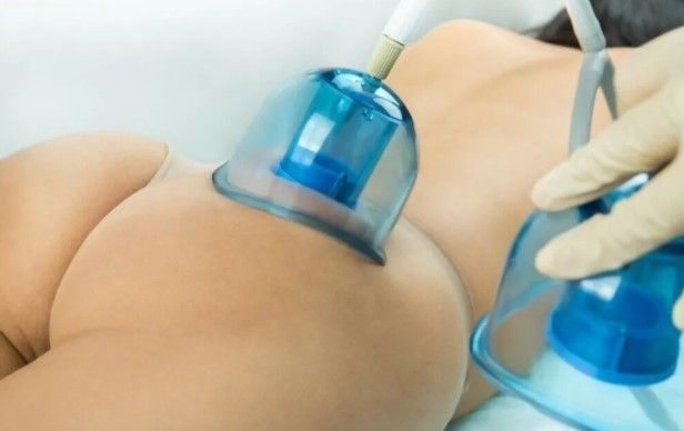 what-are-the-best-non-surgical-body-contouring-treatments-big-0
