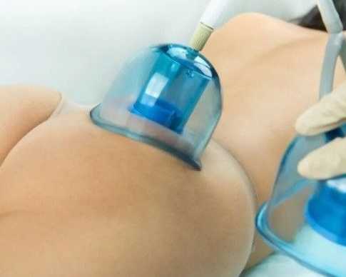 what-are-the-best-non-surgical-body-contouring-treatments