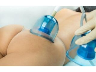 what-are-the-best-non-surgical-body-contouring-treatments-small-0