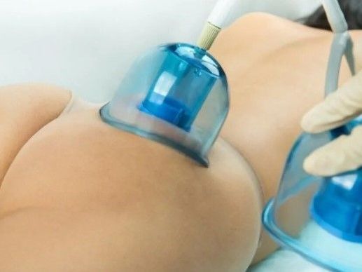 what-are-the-best-non-surgical-body-contouring-treatments
