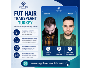 turkey-fut-hair-transplant-a-proven-solution-small-0