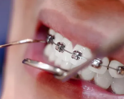 professional-dental-cleaning-near-you-call-now