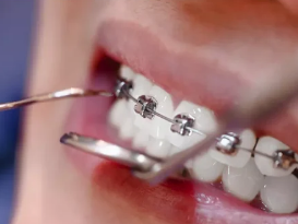 professional-dental-cleaning-near-you-call-now