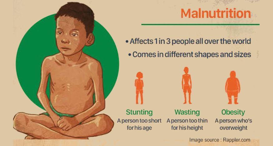 malnutrition-problem-and-need-for-holistic-solution-big-0