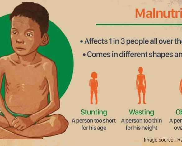 malnutrition-problem-and-need-for-holistic-solution