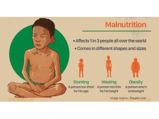 malnutrition-problem-and-need-for-holistic-solution-small-0