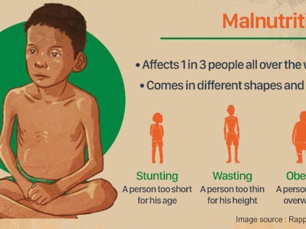 malnutrition-problem-and-need-for-holistic-solution