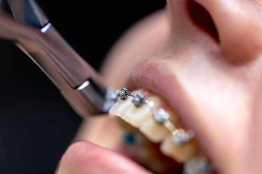 trusted-orthodontic-specialists-for-healthy-beautiful-smiles-big-0