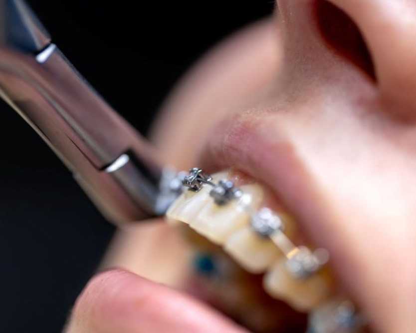 trusted-orthodontic-specialists-for-healthy-beautiful-smiles