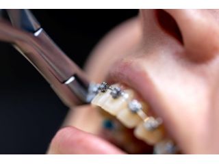 trusted-orthodontic-specialists-for-healthy-beautiful-smiles-small-0