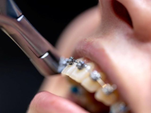 trusted-orthodontic-specialists-for-healthy-beautiful-smiles