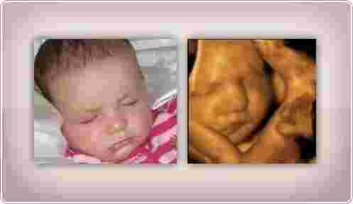 pregnancy-bonding-experience-4d-ultrasound-in-anaheim-ca-big-0