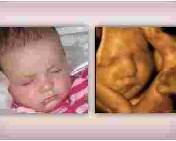 pregnancy-bonding-experience-4d-ultrasound-in-anaheim-ca