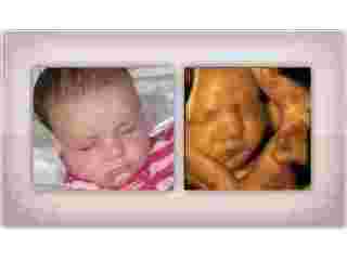 pregnancy-bonding-experience-4d-ultrasound-in-anaheim-ca-small-0