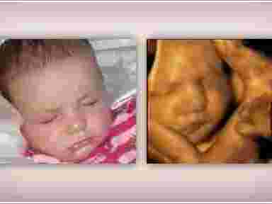 pregnancy-bonding-experience-4d-ultrasound-in-anaheim-ca