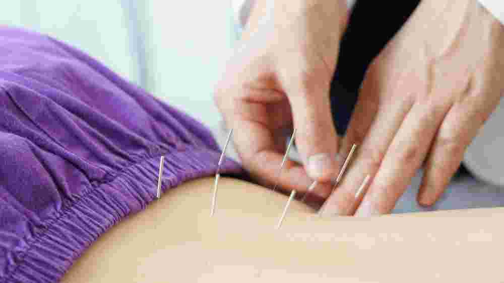 dry-needling-for-sciatica-big-0
