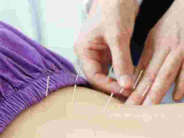 dry-needling-for-sciatica