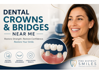 dental-crowns-and-bridges-near-me-small-0