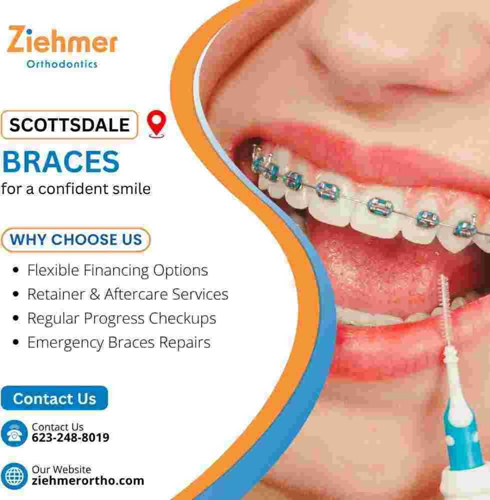 expert-scottsdale-braces-big-0
