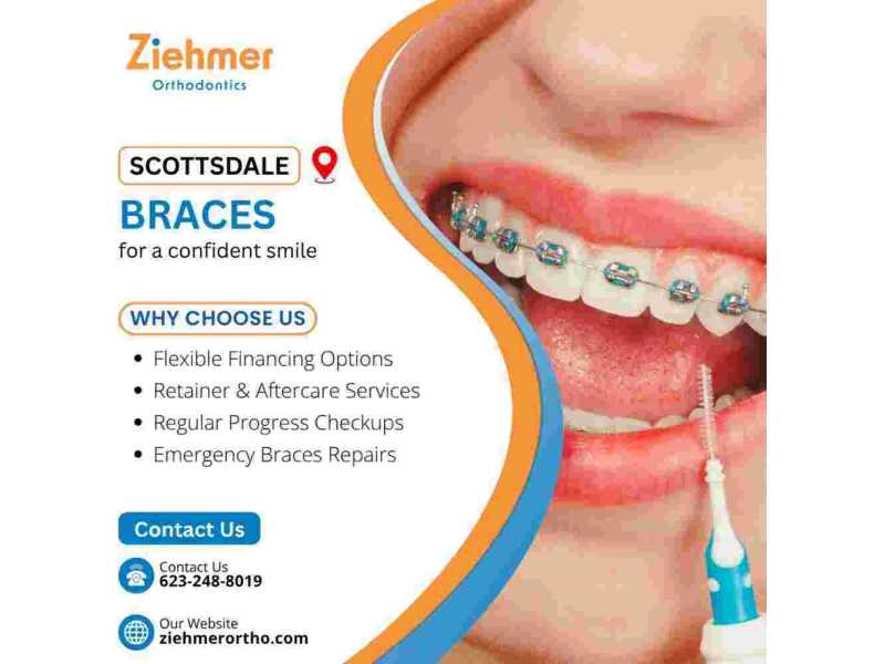 expert-scottsdale-braces-small-0