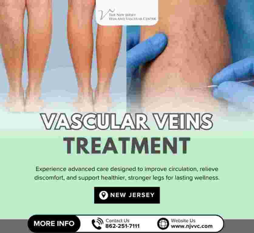 vascular-veins-treatment-in-nj-big-0