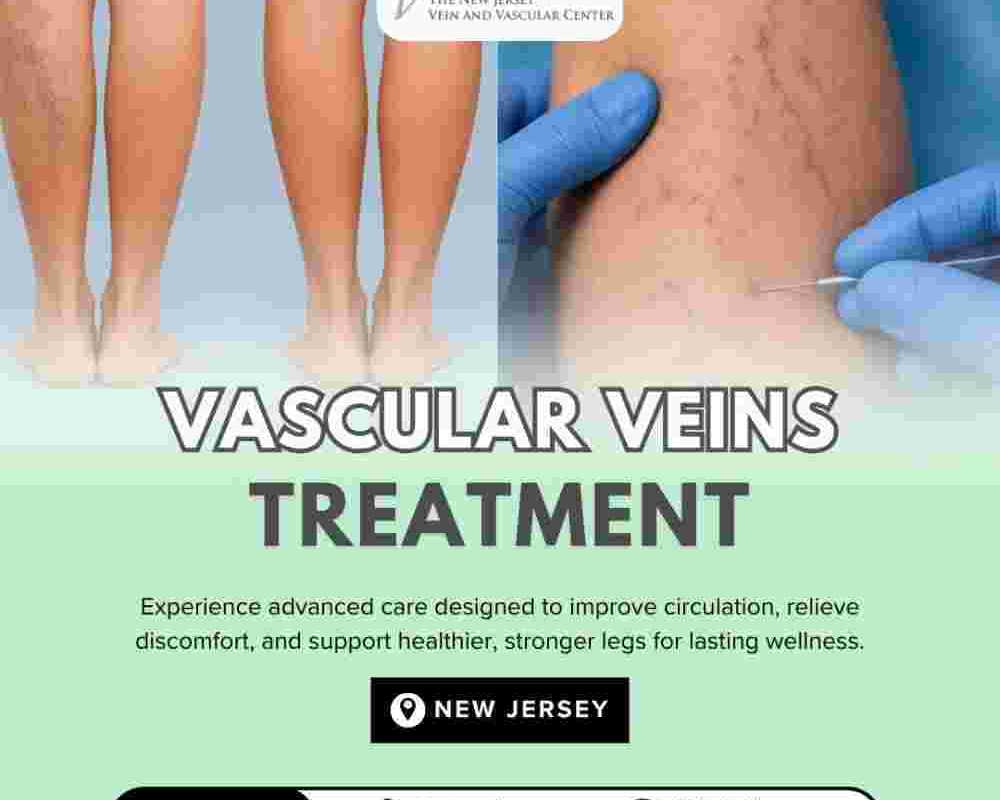vascular-veins-treatment-in-nj