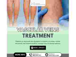 vascular-veins-treatment-in-nj-small-0
