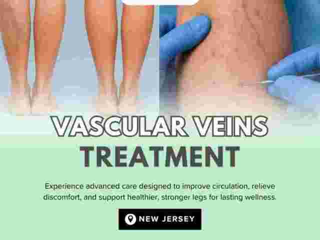 vascular-veins-treatment-in-nj